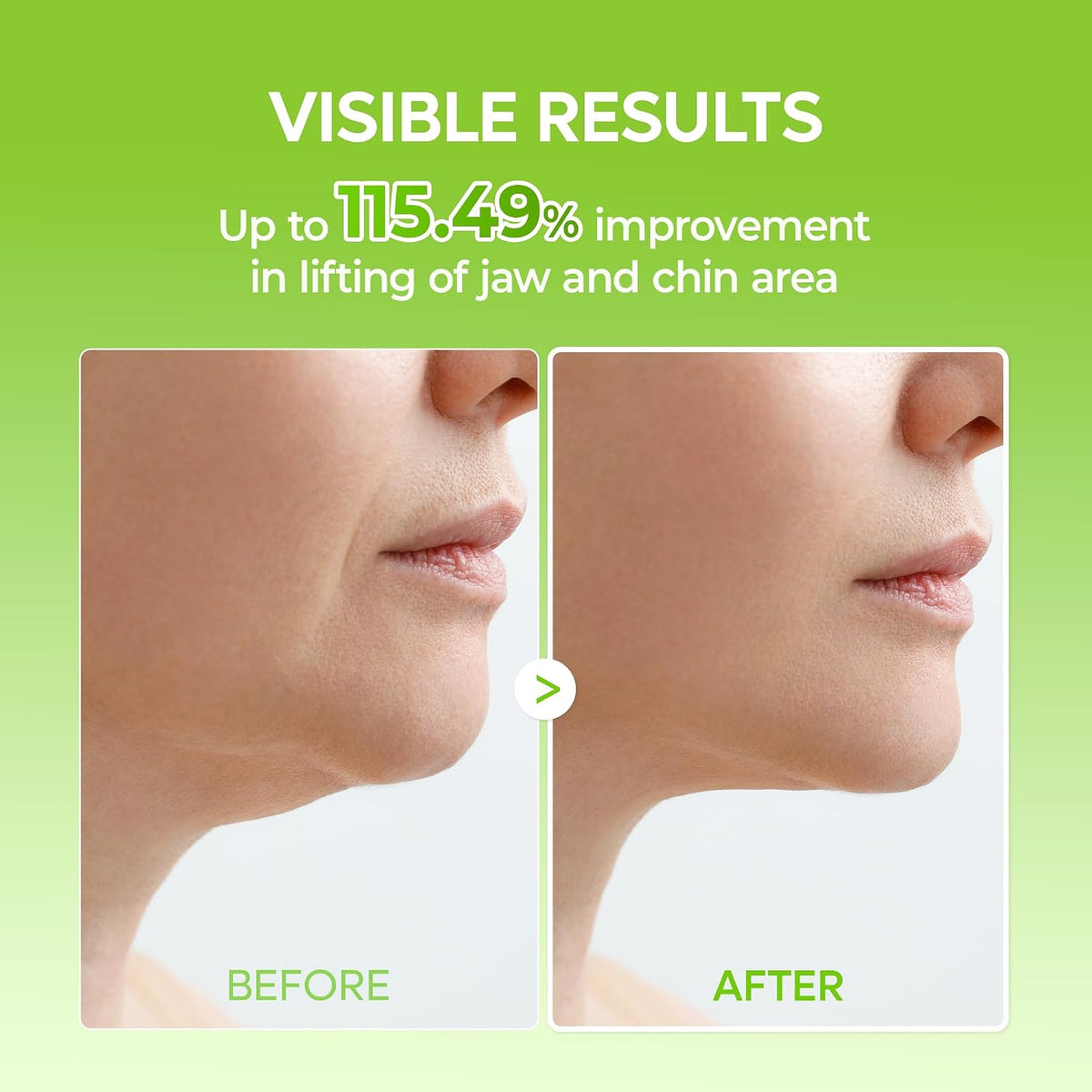 Dr.Melaxin CACTOX V-Lifting Mewing Band (1 Mask)