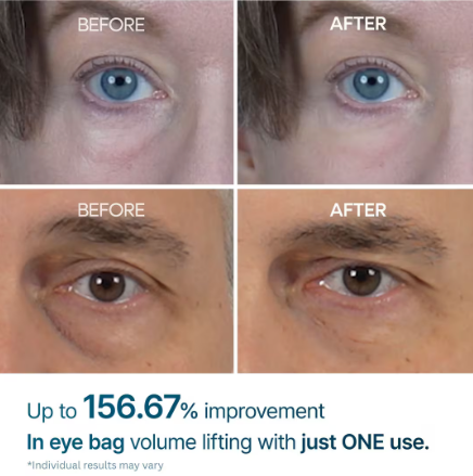 Dr. Melaxin Eyephalt Eyebag Cream