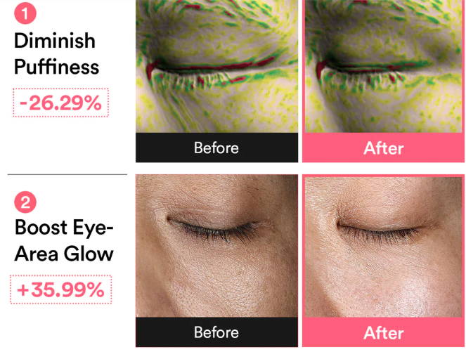 Abib - PDRN retinal eye patch I Glow Jelly