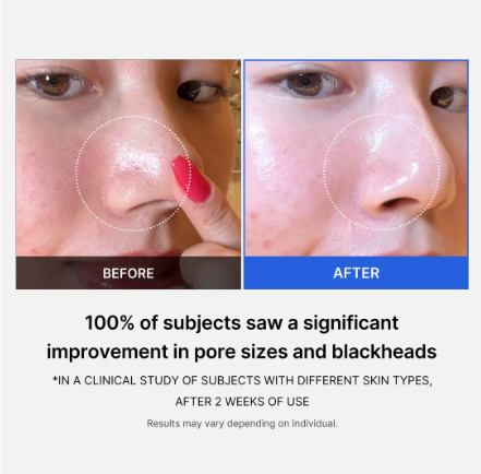 Medicube Zero Pore Pad (70 Pads)
