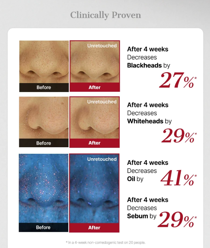 COSRX The AHA 2 BHA 2 Blemish Treatment Serum